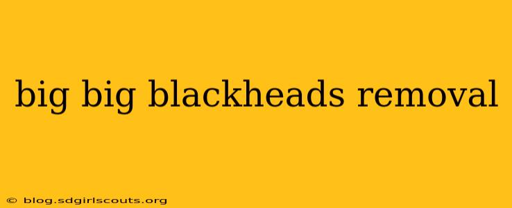 big big blackheads removal