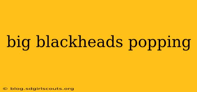 big blackheads popping