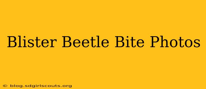 Blister Beetle Bite Photos