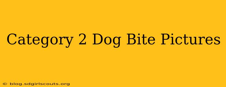 Category 2 Dog Bite Pictures