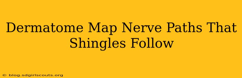 Dermatome Map Nerve Paths That Shingles Follow