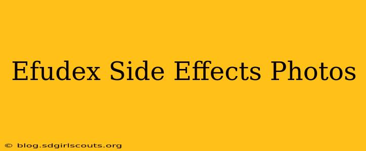 Efudex Side Effects Photos