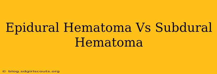 Epidural Hematoma Vs Subdural Hematoma