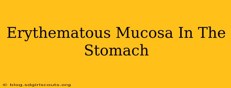 Erythematous Mucosa In The Stomach