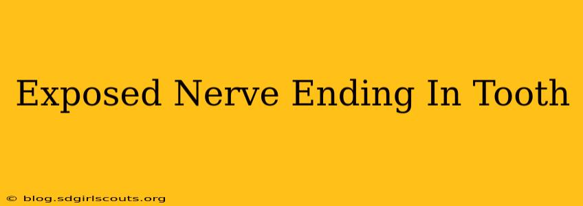 Exposed Nerve Ending In Tooth