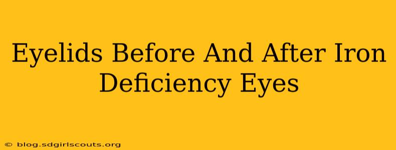 Eyelids Before And After Iron Deficiency Eyes