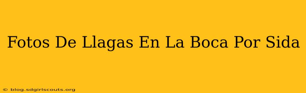 Fotos De Llagas En La Boca Por Sida