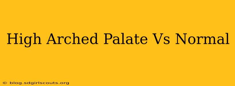 High Arched Palate Vs Normal