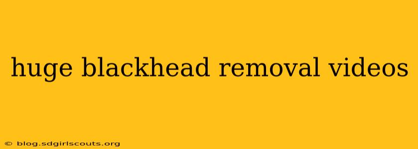 huge blackhead removal videos