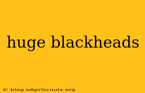 huge blackheads