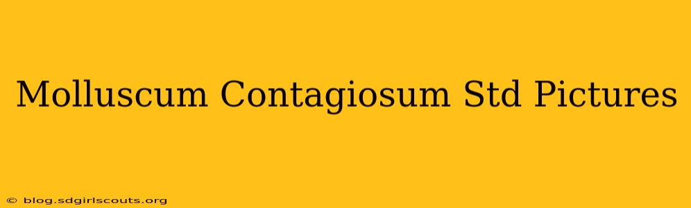 Molluscum Contagiosum Std Pictures