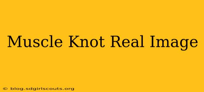 Muscle Knot Real Image