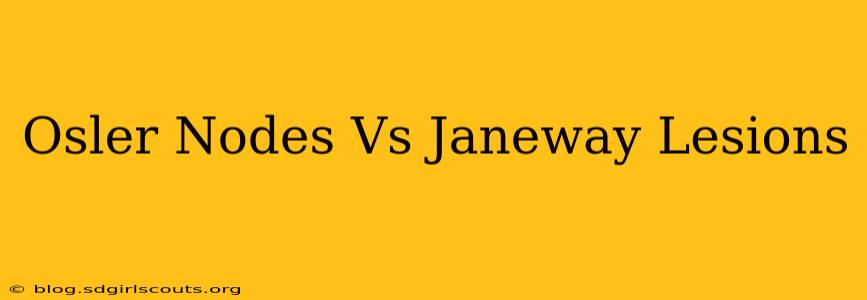 Osler Nodes Vs Janeway Lesions