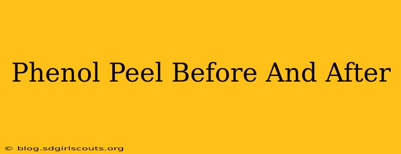 Phenol Peel Before And After