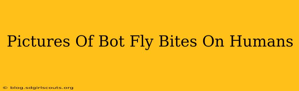 Pictures Of Bot Fly Bites On Humans