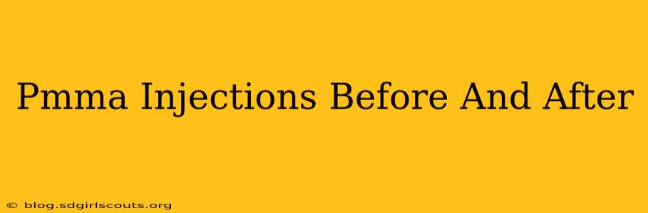 Pmma Injections Before And After