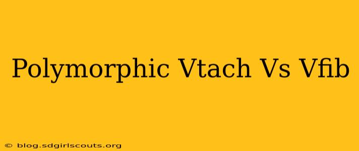 Polymorphic Vtach Vs Vfib