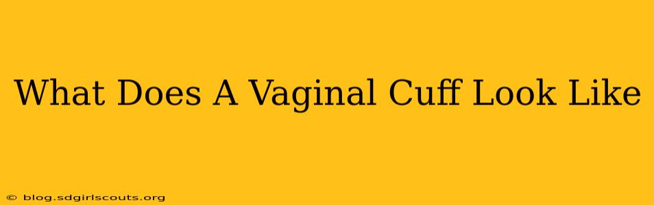 What Does A Vaginal Cuff Look Like