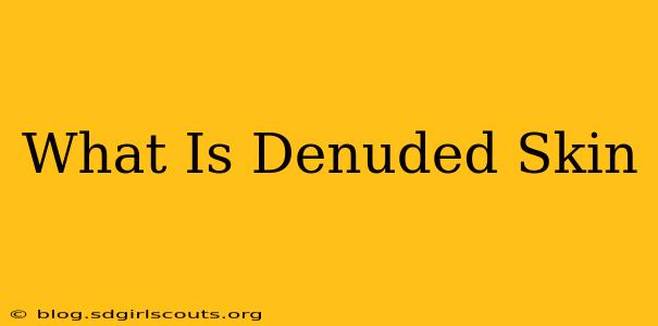 What Is Denuded Skin