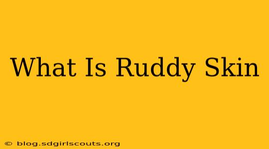 What Is Ruddy Skin